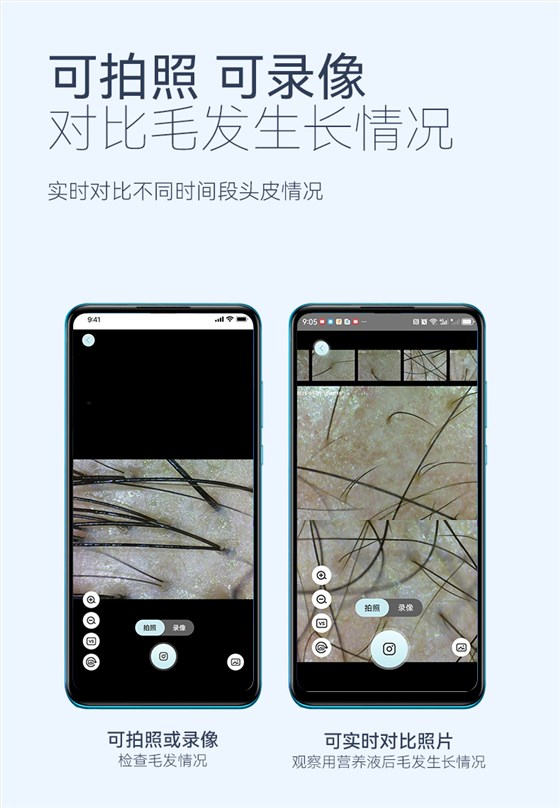 2306毛囊检测仪（新）_05