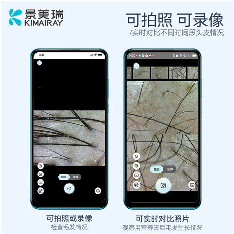 头皮检测仪